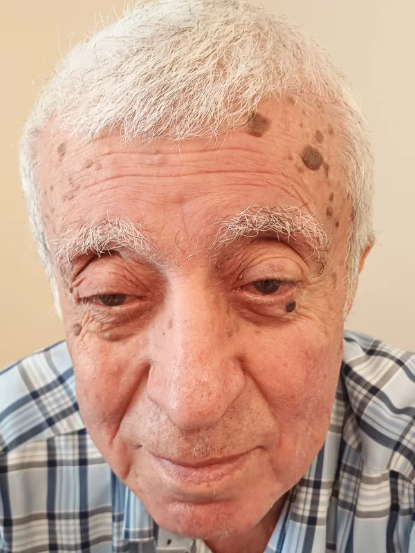RAMAZAN YILMAZ