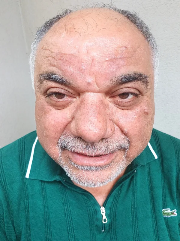 VEDAT ÖZDOĞAN